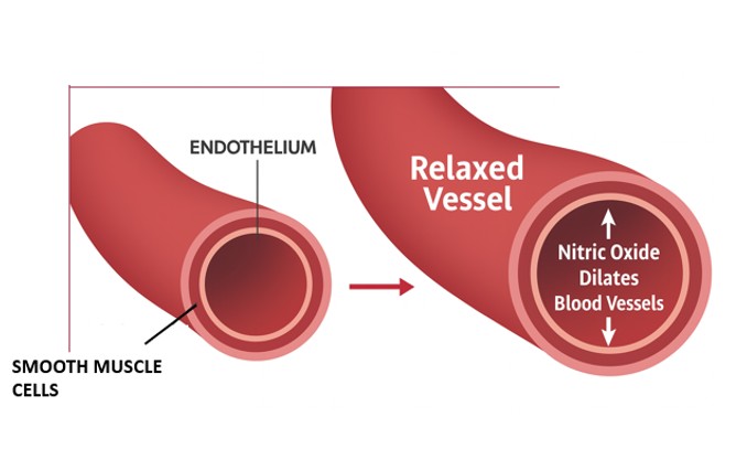 nitric oxide