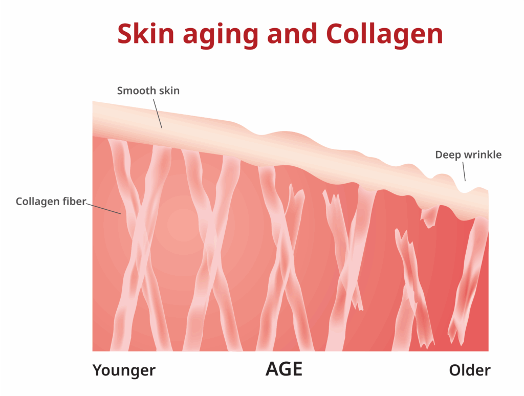 collagen and skin aging