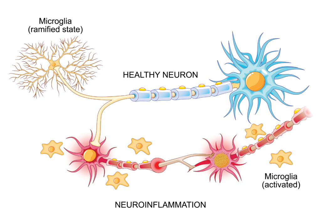 microglia