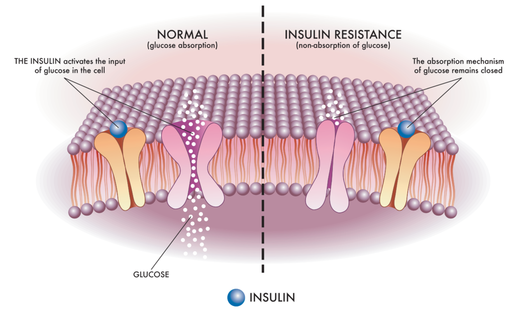 insulin resistance