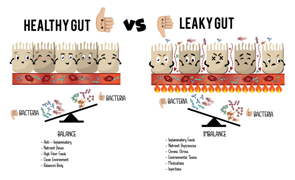 leaky gut