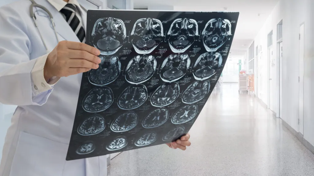 A doctor holds and examines multiple brain MRI scans in a well-lit hospital corridor, with medical doors and equipment visible in the background.