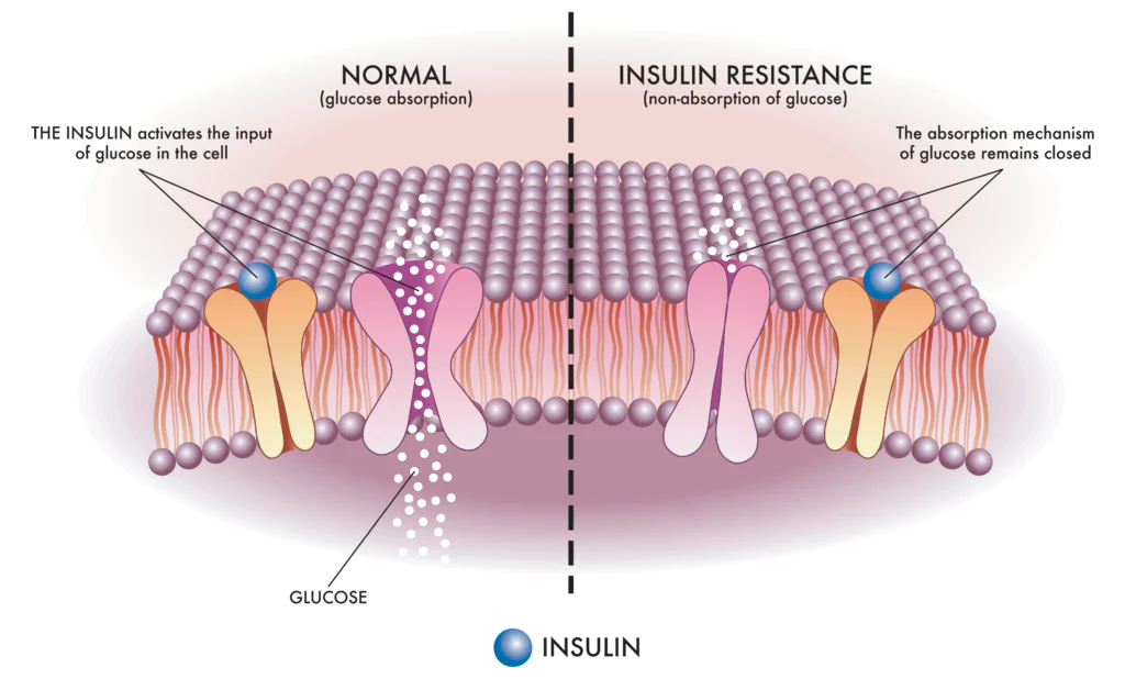insulin resistance